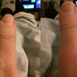 thumb